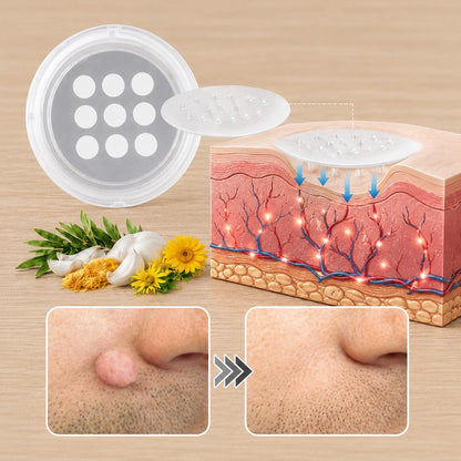 ✨ PuraCure® 2 az 1-ben mikrotűs és hidrokolloid tapasz🍀 | Kiálló anyajegyek, aknék, lapos szemölcsök és bőrnövedékek eltávolítására | Segít csökkenteni a ráncokat, hegeket és bőrhibákat | Láthatatlan tapasz az arcra és testre