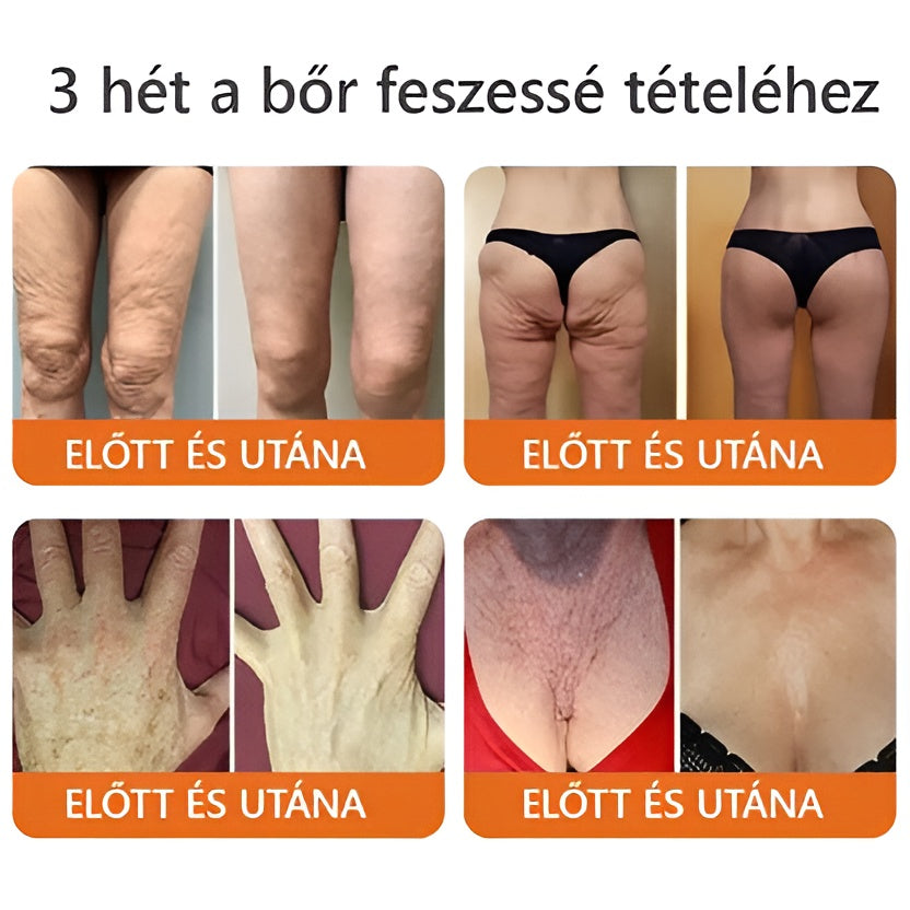 🐝🌿 Bőrgyógyász ajánlása ✨ ZödVita® Méhméreg Bőr Helyreállító Krém 🔥 Magyar fejlesztés, magyarországi gyártás és szállítás