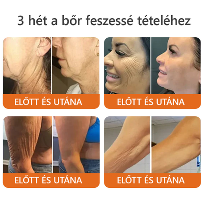 ⭐⭐ ZödVita® Méhméreg Bőr Helyreállító Krém (👨‍⚕‍CE jóváhagyott)👍✅
