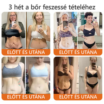 🐝🌿 Bőrgyógyász ajánlása ✨ ZödVita® Méhméreg Bőr Helyreállító Krém 🔥 Magyar fejlesztés, magyarországi gyártás és szállítás