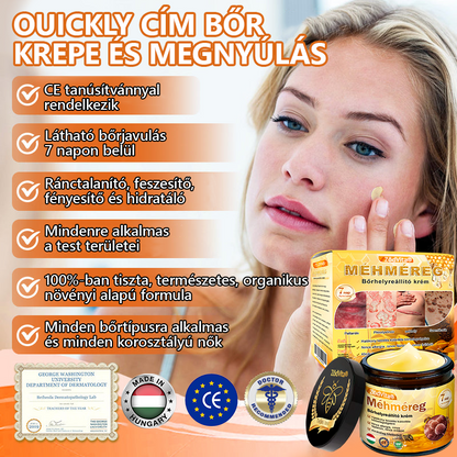 ⭐⭐ ZödVita® Méhméreg Bőr Helyreállító Krém (👨‍⚕‍CE jóváhagyott)👍✅