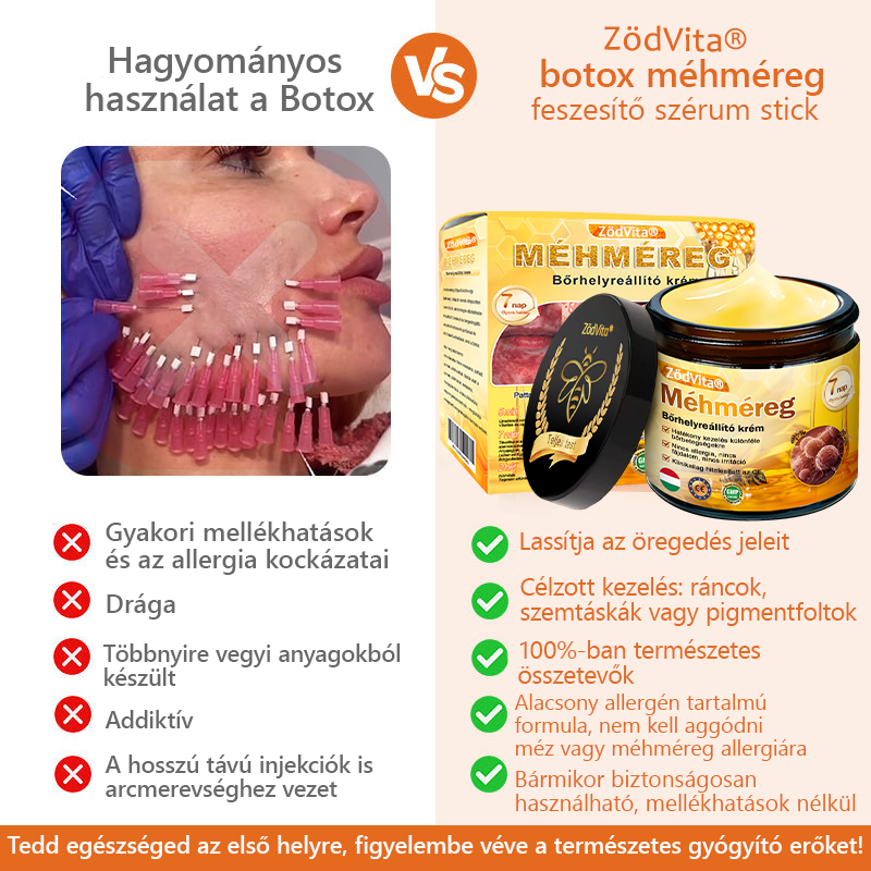 🐝🌿 Bőrgyógyász ajánlása ✨ ZödVita® Méhméreg Bőr Helyreállító Krém 🔥 Magyar fejlesztés, magyarországi gyártás és szállítás