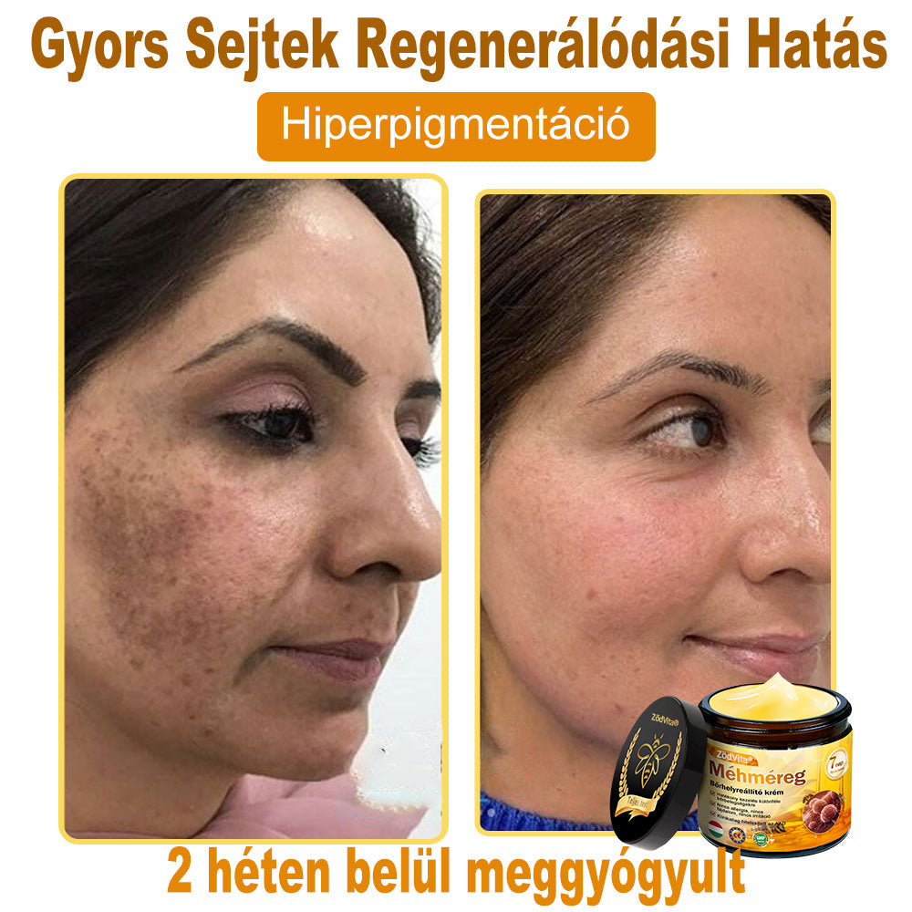 🐝🌿 Bőrgyógyász ajánlása ✨ ZödVita® Méhméreg Bőr Helyreállító Krém 🔥 Magyar fejlesztés, magyarországi gyártás és szállítás
