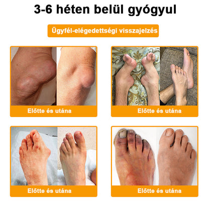 🟢𝑺𝒕𝒂𝒘𝑽𝒊𝒕𝒂𝒍® Botoxot és Méhmérget Tartalmazó Regeneráló Krém Ízületekre és Csontokra | MOT (Magyar Ortopéd Társaság) által tanúsított termék