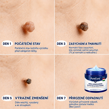 PuraCure® 𝟕 𝐍𝐚𝐩𝐨𝐬 𝐊𝐫é𝐦 𝐁ő𝐫𝐟ü𝐠𝐠𝐞𝐥é𝐤𝐞𝐤 é𝐬 𝐏𝐢𝐠𝐦𝐞𝐧𝐭𝐟𝐨𝐥𝐭𝐨𝐤 𝐄𝐥𝐥𝐞𝐧 (𝐅á𝐣𝐝𝐚𝐥𝐨𝐦𝐦𝐞𝐧𝐭𝐞𝐬 𝐅𝐨𝐫𝐦𝐮𝐥𝐚 – 𝐇𝐞𝐠𝐞𝐤 𝐍é𝐥𝐤ü𝐥)🍁