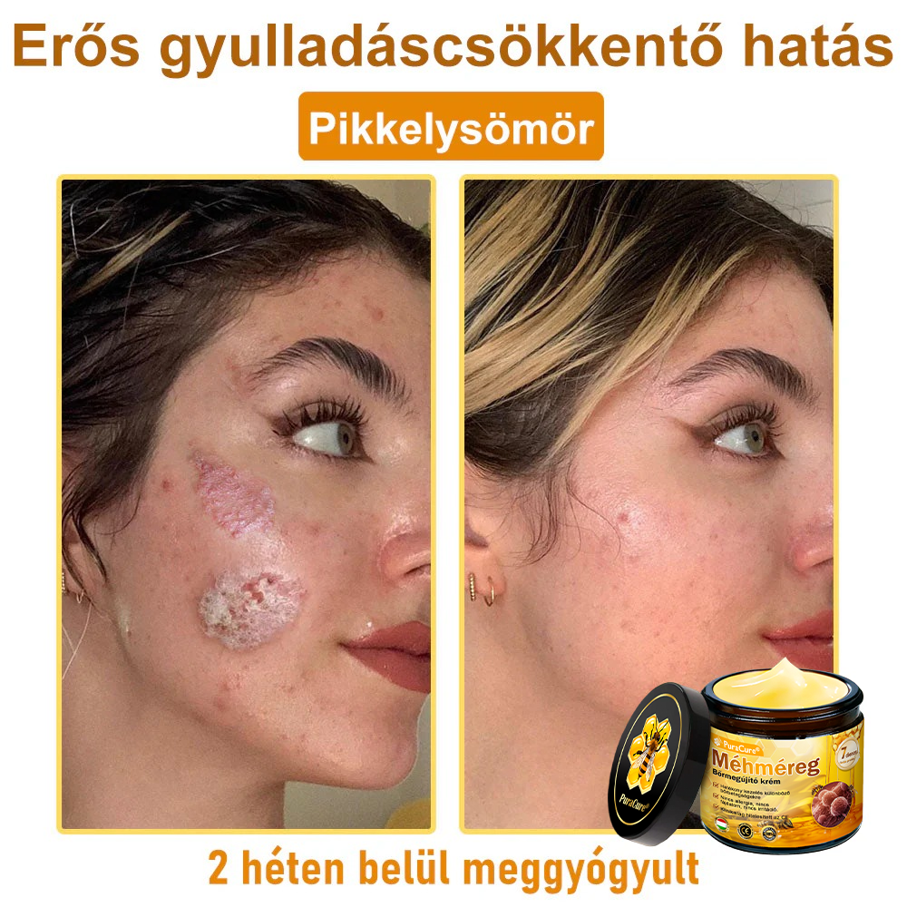 🌟 PuraCure® Méhméreg Bőr Helyreállító Krém (👨‍⚕‍CE Tanúsítvány)👍✅