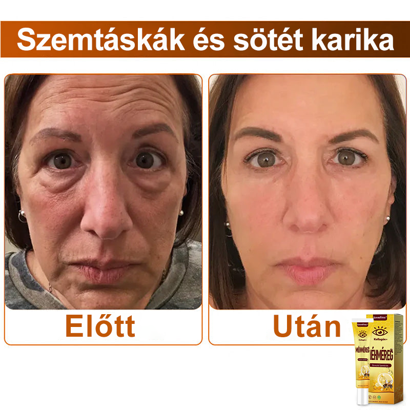 ✨💛✨SzemFény™ Kollagén+ Méhméreg Ébresztő Szemkrém - CE minősítést szerzett - Minden bőrtípusra alkalmazható
