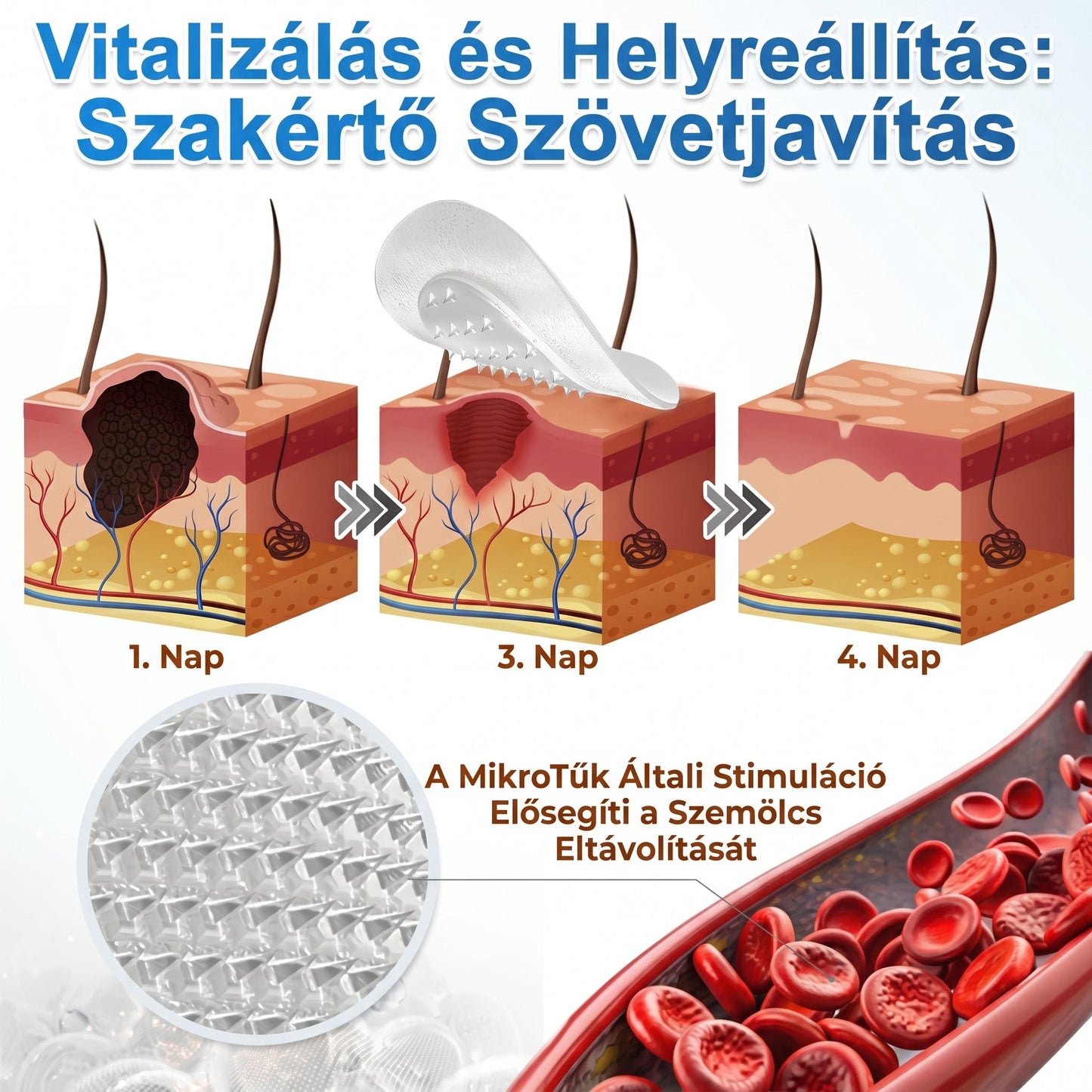 PuraCure® 2 az 1-ben mikrotűs és hidrokolloid tapasz🍀 | Kiálló anyajegyek, aknék, lapos szemölcsök és bőrnövedékek eltávolítására | Segít csökkenteni a ráncokat, hegeket és bőrhibákat | Láthatatlan tapasz az arcra és testre