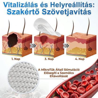 PuraCure® 2 az 1-ben mikrotűs és hidrokolloid tapasz🍀 | Kiálló anyajegyek, aknék, lapos szemölcsök és bőrnövedékek eltávolítására | Segít csökkenteni a ráncokat, hegeket és bőrhibákat | Láthatatlan tapasz az arcra és testre