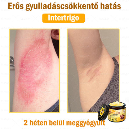 ✨✨✨💪VLSVLS® Méhméreg Bőrhelyreállító Krém (👨‍⚕‍CE jóváhagyott)👍✅