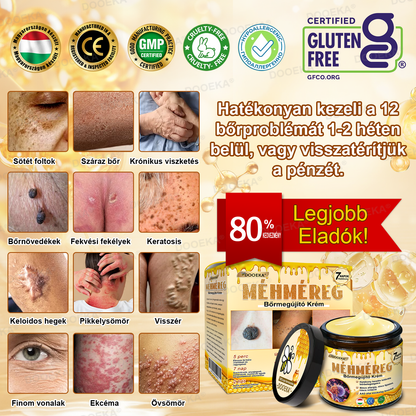 🌿 OGYÉI által jóváhagyva: DOOEKA® Méhméreg Bőrmegújító Krém — 🔥Korlátozott ideig 80% kedvezmény🔥
