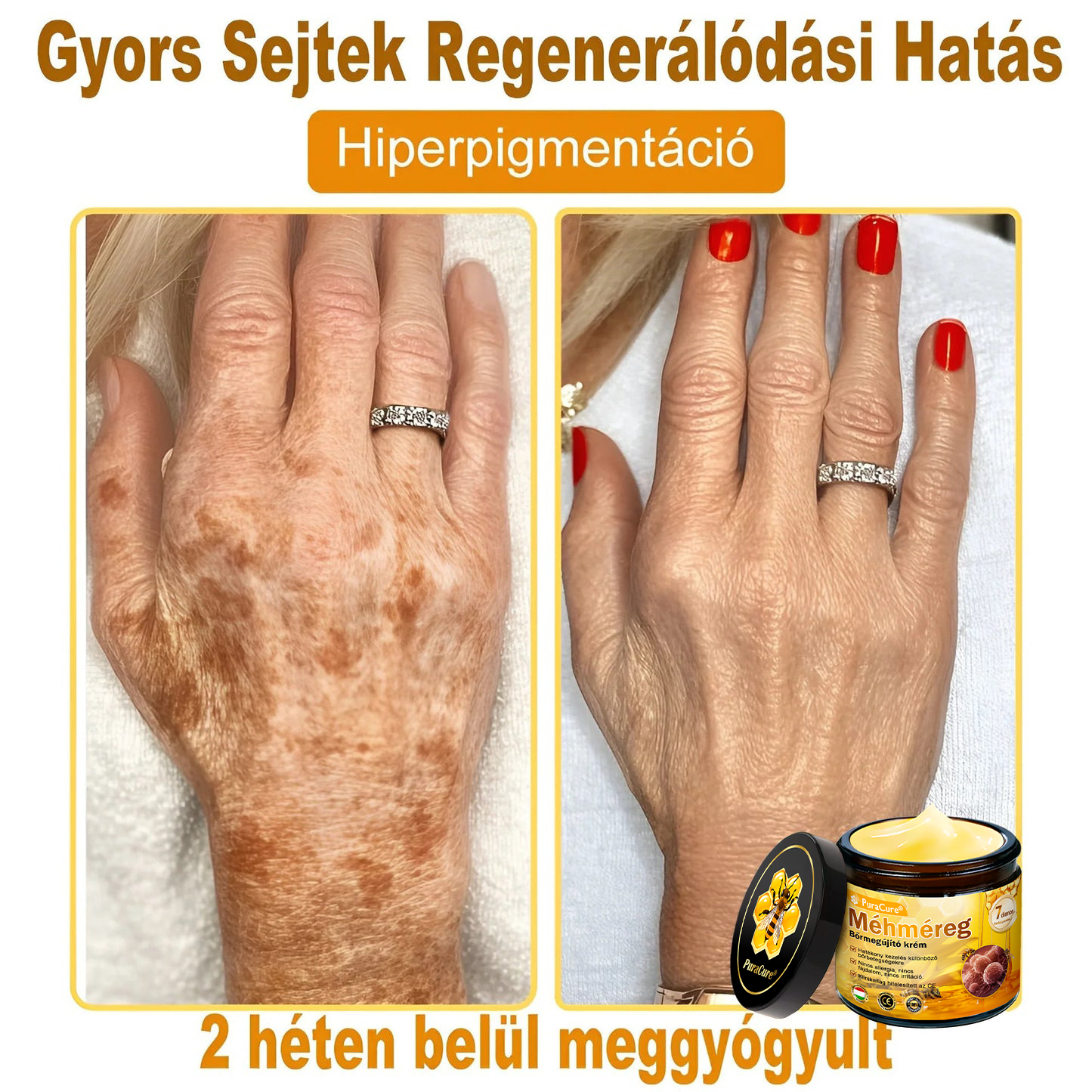 🌟 PuraCure® Méhméreg Bőr Helyreállító Krém (👨‍⚕‍CE Tanúsítvány)👍✅