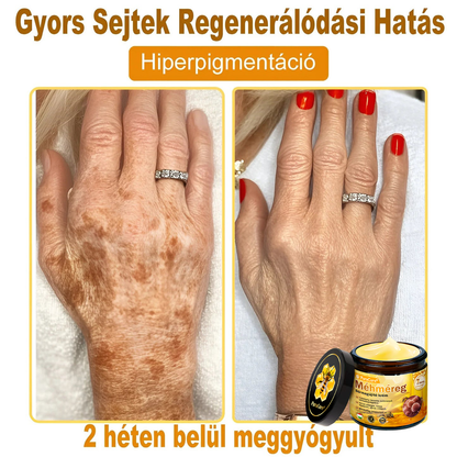 🌟 PuraCure® Méhméreg Bőr Helyreállító Krém (👨‍⚕‍CE Tanúsítvány)👍✅