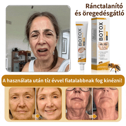 FrissArc™ Botox Méhméreg Ránctalanító Krém, Kétszeres hatású anti-aging krém