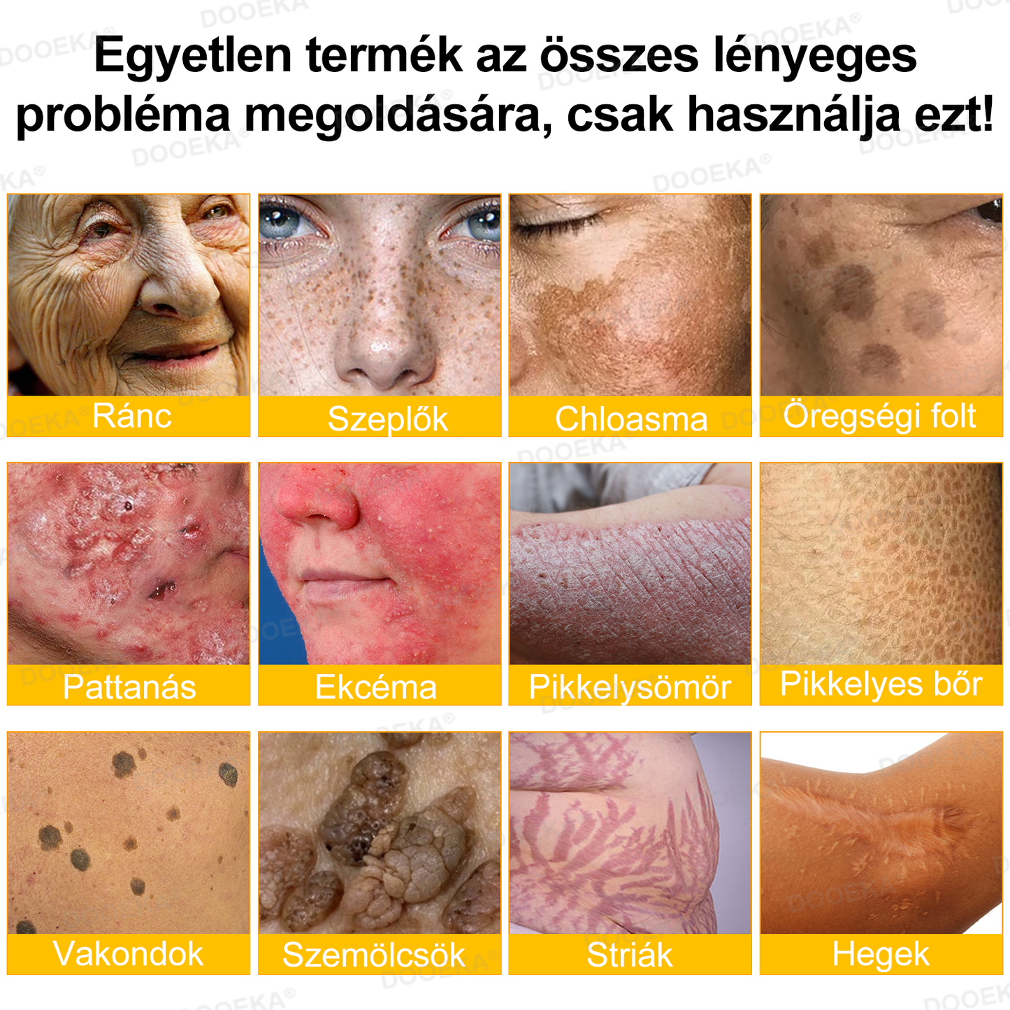 🌿 OGYÉI által jóváhagyva: DOOEKA® Méhméreg Bőrmegújító Krém — 🔥Korlátozott ideig 80% kedvezmény🔥