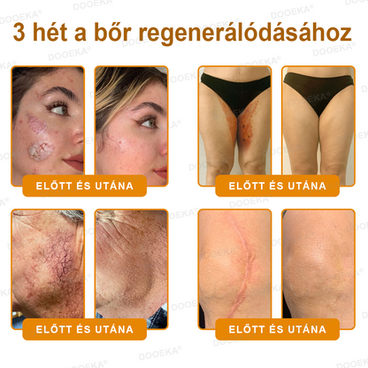 🌿 OGYÉI által jóváhagyva: DOOEKA® Méhméreg Bőrmegújító Krém — 🔥Korlátozott ideig 80% kedvezmény🔥