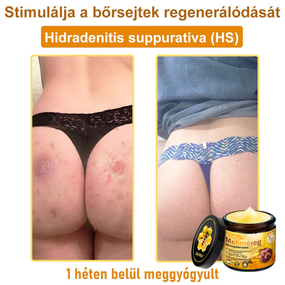 🐝🌿 ZödVita® Méhméreg Bőr Helyreállító Krém (👨‍⚕‍CE Tanúsítvány)👍✅