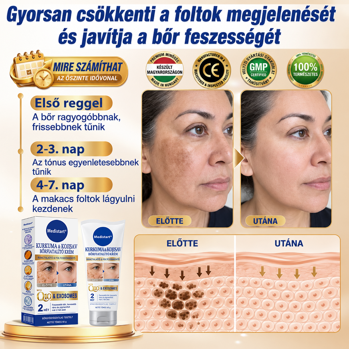 𝐌𝐞𝐝𝐢𝐬𝐭𝐚𝐫𝐭® 𝐊𝐮𝐫𝐤𝐮𝐦𝐚 × 𝐊𝐨𝐣𝐢𝐧𝐬𝐚𝐯 𝐄́𝐣𝐬𝐳𝐚𝐤𝐚𝐢 Bőrfiatalító 𝐊𝐫𝐞́𝐦— 𝐇𝐚𝐥𝐯𝐚́𝐧𝐲𝐢́𝐭𝐬𝐝 𝐚 𝐦𝐚𝐤𝐚𝐜𝐬 𝐬𝐨̈𝐭𝐞́𝐭 𝐟𝐨𝐥𝐭𝐨𝐤𝐚𝐭 𝐞́𝐬 𝐬𝐢𝐦𝐢́𝐭𝐬𝐝 𝐤𝐢 𝐚 𝐥𝐚́𝐭𝐡𝐚𝐭𝐨́ 𝐫𝐚́𝐧𝐜𝐨𝐤𝐚𝐭 𝐚𝐥𝐯𝐚́𝐬 𝐤𝐨̈𝐳𝐛𝐞𝐧 🌙 ✅ 𝐄́𝐣𝐬𝐳𝐚𝐤𝐚́𝐧𝐤𝐞́𝐧𝐭 𝐞𝐠𝐲 𝐥𝐞́𝐩𝐞́𝐬 · 𝐋𝐚́𝐭𝐡𝐚𝐭𝐨́ 𝐯𝐚́𝐥𝐭𝐨𝐳𝐚́𝐬 𝟕 𝐞́𝐣𝐬𝐳𝐚𝐤𝐚 𝐚𝐥𝐚𝐭𝐭