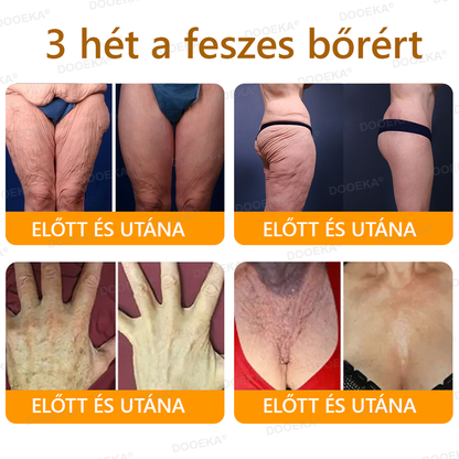 🌿 OGYÉI által jóváhagyva: DOOEKA® Méhméreg Bőrmegújító Krém — 🔥Korlátozott ideig 80% kedvezmény🔥
