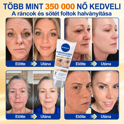 𝐌𝐞𝐝𝐢𝐬𝐭𝐚𝐫𝐭® 𝐊𝐮𝐫𝐤𝐮𝐦𝐚 × 𝐊𝐨𝐣𝐢𝐧𝐬𝐚𝐯 𝐄́𝐣𝐬𝐳𝐚𝐤𝐚𝐢 Bőrfiatalító 𝐊𝐫𝐞́𝐦— 𝐇𝐚𝐥𝐯𝐚́𝐧𝐲𝐢́𝐭𝐬𝐝 𝐚 𝐦𝐚𝐤𝐚𝐜𝐬 𝐬𝐨̈𝐭𝐞́𝐭 𝐟𝐨𝐥𝐭𝐨𝐤𝐚𝐭 𝐞́𝐬 𝐬𝐢𝐦𝐢́𝐭𝐬𝐝 𝐤𝐢 𝐚 𝐥𝐚́𝐭𝐡𝐚𝐭𝐨́ 𝐫𝐚́𝐧𝐜𝐨𝐤𝐚𝐭 𝐚𝐥𝐯𝐚́𝐬 𝐤𝐨̈𝐳𝐛𝐞𝐧 🌙 ✅ 𝐄́𝐣𝐬𝐳𝐚𝐤𝐚́𝐧𝐤𝐞́𝐧𝐭 𝐞𝐠𝐲 𝐥𝐞́𝐩𝐞́𝐬 · 𝐋𝐚́𝐭𝐡𝐚𝐭𝐨́ 𝐯𝐚́𝐥𝐭𝐨𝐳𝐚́𝐬 𝟕 𝐞́𝐣𝐬𝐳𝐚𝐤𝐚 𝐚𝐥𝐚𝐭𝐭