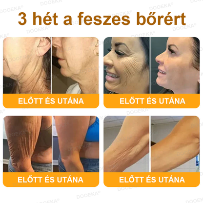 🌿 OGYÉI által jóváhagyva: DOOEKA® Méhméreg Bőrmegújító Krém — 🔥Korlátozott ideig 80% kedvezmény🔥