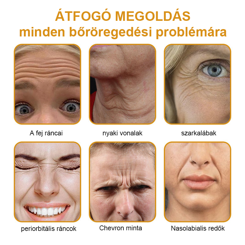 FRISSARC™🏵️ Botox Méhméreg Ránctalanító Krém