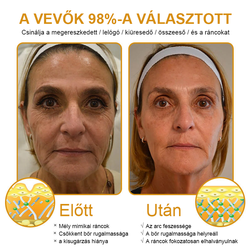 FrissArc™ Botox Méhméreg Ránctalanító Krém, Kétszeres hatású anti-aging krém