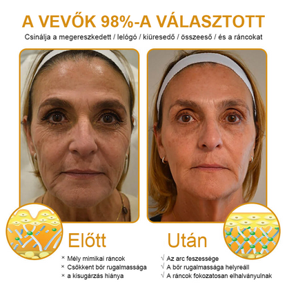 FRISSARC™🏵️ Botox Méhméreg Ránctalanító Krém
