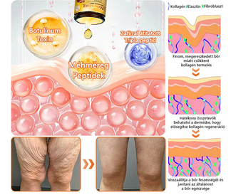 🌟 PuraCure® Méhméreg Bőr Helyreállító Krém (👨‍⚕‍CE Tanúsítvány)👍✅
