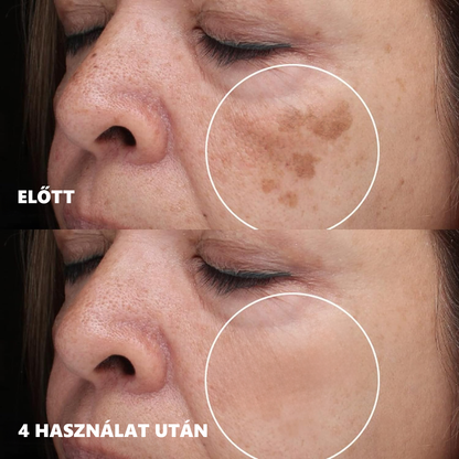 (40%-60% kedvezmény élvezete) 𝐅𝐑𝐈𝐒𝐒𝐀𝐑𝐂™ Fehérítő És Folteltávolító Arcmaszk - Természetes összetevők tartósan eltüntetik a foltokat, szeplőket és napfoltokat.