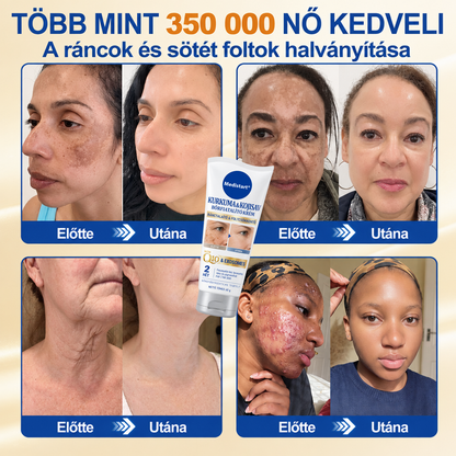 𝐌𝐞𝐝𝐢𝐬𝐭𝐚𝐫𝐭® 𝐊𝐮𝐫𝐤𝐮𝐦𝐚 × 𝐊𝐨𝐣𝐢𝐧𝐬𝐚𝐯 𝐄́𝐣𝐬𝐳𝐚𝐤𝐚𝐢 Bőrfiatalító 𝐊𝐫𝐞́𝐦— 𝐇𝐚𝐥𝐯𝐚́𝐧𝐲𝐢́𝐭𝐬𝐝 𝐚 𝐦𝐚𝐤𝐚𝐜𝐬 𝐬𝐨̈𝐭𝐞́𝐭 𝐟𝐨𝐥𝐭𝐨𝐤𝐚𝐭 𝐞́𝐬 𝐬𝐢𝐦𝐢́𝐭𝐬𝐝 𝐤𝐢 𝐚 𝐥𝐚́𝐭𝐡𝐚𝐭𝐨́ 𝐫𝐚́𝐧𝐜𝐨𝐤𝐚𝐭 𝐚𝐥𝐯𝐚́𝐬 𝐤𝐨̈𝐳𝐛𝐞𝐧 🌙 ✅ 𝐄́𝐣𝐬𝐳𝐚𝐤𝐚́𝐧𝐤𝐞́𝐧𝐭 𝐞𝐠𝐲 𝐥𝐞́𝐩𝐞́𝐬 · 𝐋𝐚́𝐭𝐡𝐚𝐭𝐨́ 𝐯𝐚́𝐥𝐭𝐨𝐳𝐚́𝐬 𝟕 𝐞́𝐣𝐬𝐳𝐚𝐤𝐚 𝐚𝐥𝐚𝐭𝐭