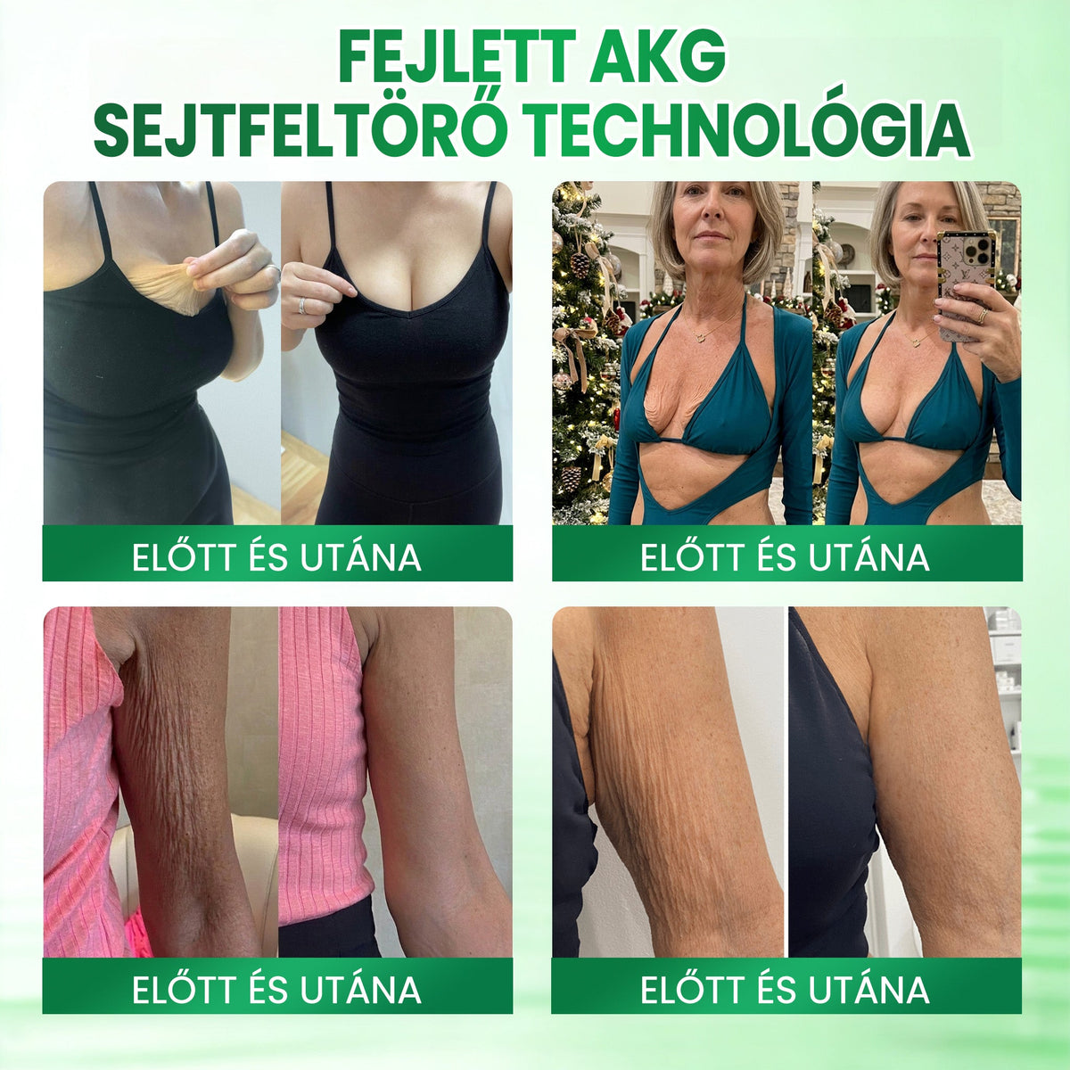 Medistart® AKG BŐRFESZESÍTŐ & ÖREGEDÉS ELLENI ÁPOLÁS