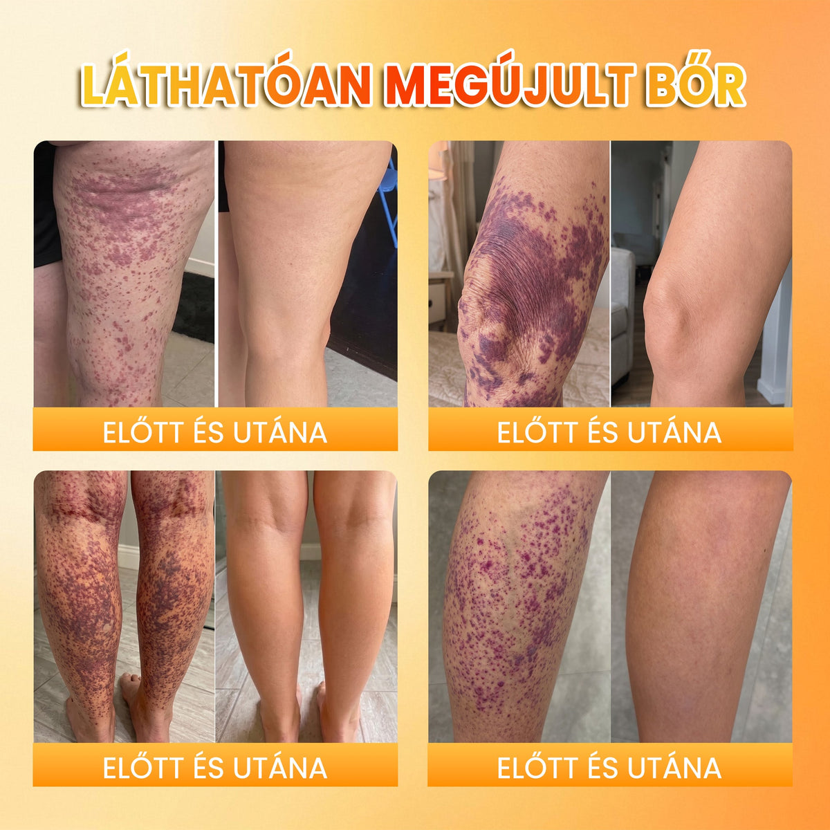 PuraCure® MÉHMÉREG Bőrmegújító krém