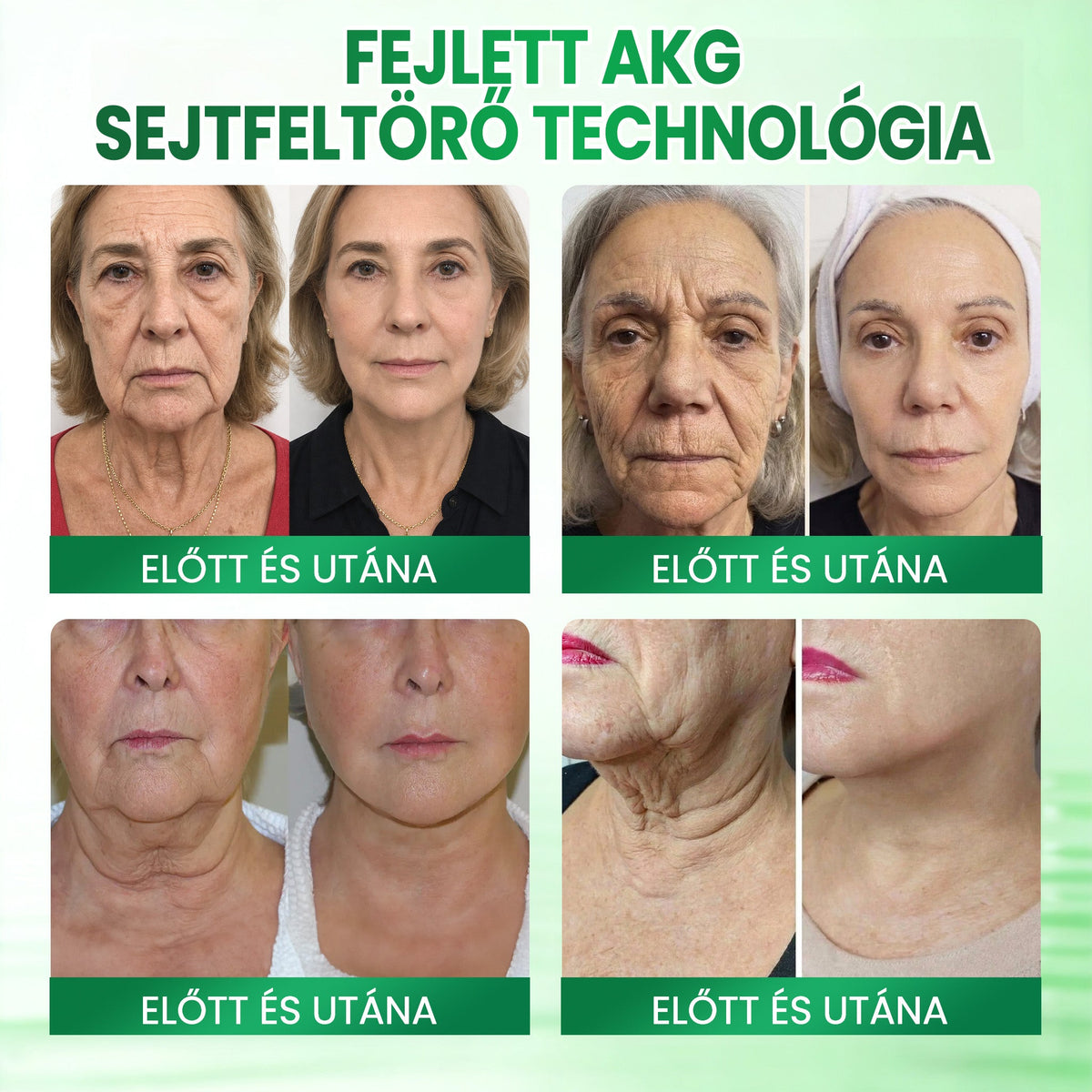 Medistart® AKG BŐRFESZESÍTŐ & ÖREGEDÉS ELLENI ÁPOLÁS