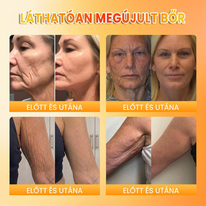 🍂 PuraCure® MÉHMÉREG Bőrmegújító krém (👨‍⚕‍CE Tanúsítvány)👍✅
