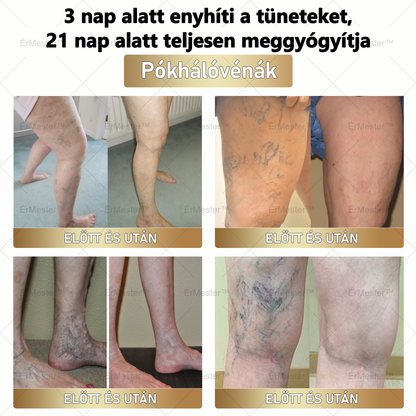 ⭐ ÉrMester™  Természetes Vénás Javító Lábfürdő Gélgolyók