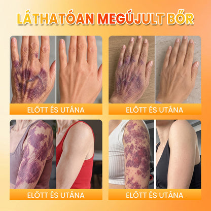 PuraCure® MÉHMÉREG Bőrmegújító krém