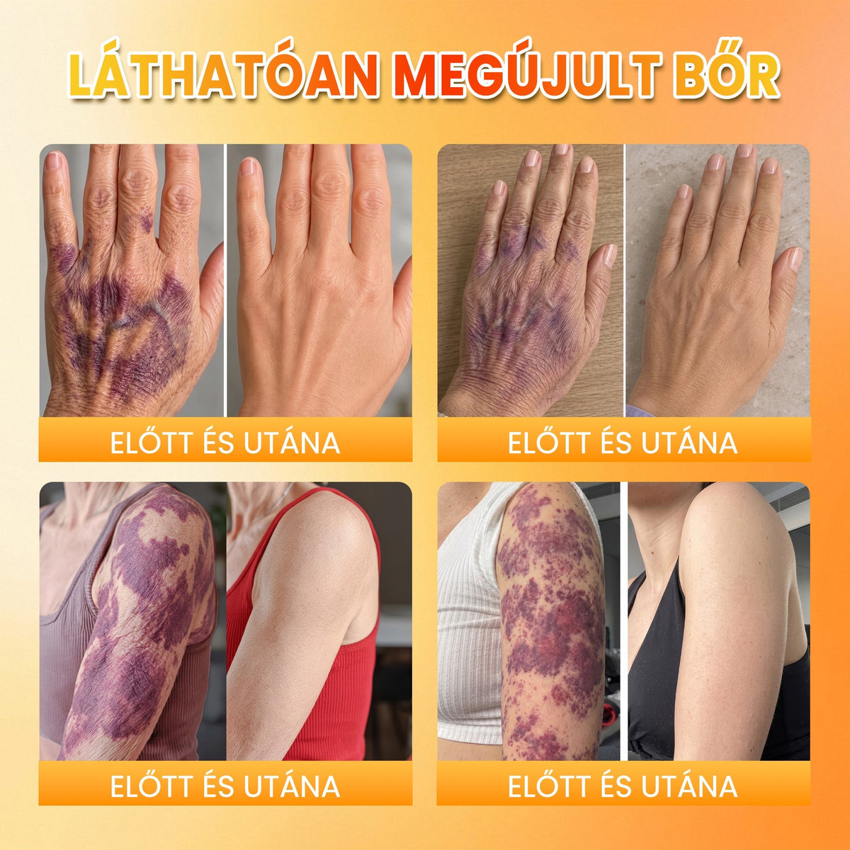 🍂 PuraCure® MÉHMÉREG Bőrmegújító krém (👨‍⚕‍CE Tanúsítvány)👍✅