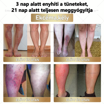 ⭐ ÉrMester™  Természetes Vénás Javító Lábfürdő Gélgolyók