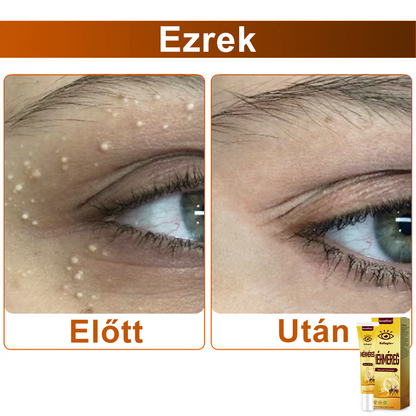 ✨💛✨SzemFény™ Kollagén+ Méhméreg Ébresztő Szemkrém - CE minősítést szerzett - Minden bőrtípusra alkalmazható