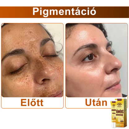 ✨💛✨SzemFény™ Kollagén+ Méhméreg Ébresztő Szemkrém - CE minősítést szerzett - Minden bőrtípusra alkalmazható