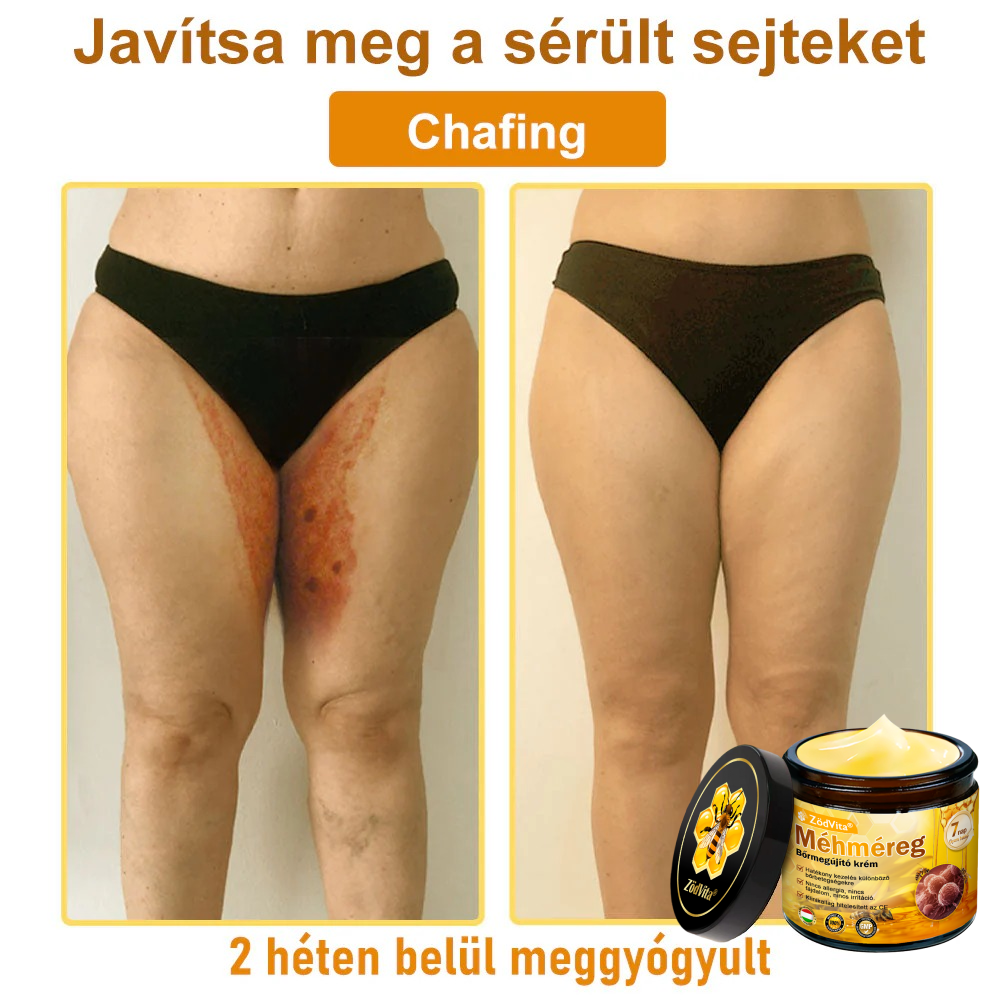 𝒁ö𝒅𝑽𝒊𝒕𝒂® Méhméreg Bőr Helyreállító Krém 🔥 Magyar fejlesztés, magyarországi gyártás és szállítás