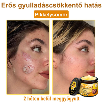 🐝🌸 Bőrgyógyász ajánlása ✨ ZödVita® Méhméreg Bőr Helyreállító Krém 🔥 Magyar fejlesztés, magyarországi gyártás és szállítás