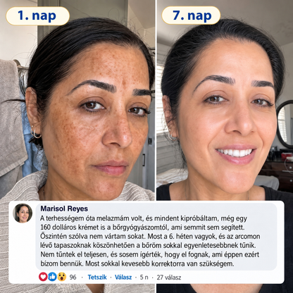 𝐌𝐞𝐝𝐢𝐬𝐭𝐚𝐫𝐭® 𝐊𝐮𝐫𝐤𝐮𝐦𝐚 × 𝐊𝐨𝐣𝐢𝐧𝐬𝐚𝐯 𝐄́𝐣𝐬𝐳𝐚𝐤𝐚𝐢 Bőrfiatalító 𝐊𝐫𝐞́𝐦— 𝐇𝐚𝐥𝐯𝐚́𝐧𝐲𝐢́𝐭𝐬𝐝 𝐚 𝐦𝐚𝐤𝐚𝐜𝐬 𝐬𝐨̈𝐭𝐞́𝐭 𝐟𝐨𝐥𝐭𝐨𝐤𝐚𝐭 𝐞́𝐬 𝐬𝐢𝐦𝐢́𝐭𝐬𝐝 𝐤𝐢 𝐚 𝐥𝐚́𝐭𝐡𝐚𝐭𝐨́ 𝐫𝐚́𝐧𝐜𝐨𝐤𝐚𝐭 𝐚𝐥𝐯𝐚́𝐬 𝐤𝐨̈𝐳𝐛𝐞𝐧 🌙 ✅ 𝐄́𝐣𝐬𝐳𝐚𝐤𝐚́𝐧𝐤𝐞́𝐧𝐭 𝐞𝐠𝐲 𝐥𝐞́𝐩𝐞́𝐬 · 𝐋𝐚́𝐭𝐡𝐚𝐭𝐨́ 𝐯𝐚́𝐥𝐭𝐨𝐳𝐚́𝐬 𝟕 𝐞́𝐣𝐬𝐳𝐚𝐤𝐚 𝐚𝐥𝐚𝐭𝐭