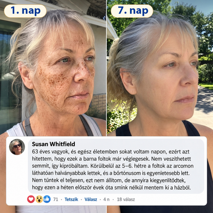 𝐌𝐞𝐝𝐢𝐬𝐭𝐚𝐫𝐭® 𝐊𝐮𝐫𝐤𝐮𝐦𝐚 × 𝐊𝐨𝐣𝐢𝐧𝐬𝐚𝐯 𝐄́𝐣𝐬𝐳𝐚𝐤𝐚𝐢 Bőrfiatalító 𝐊𝐫𝐞́𝐦— 𝐇𝐚𝐥𝐯𝐚́𝐧𝐲𝐢́𝐭𝐬𝐝 𝐚 𝐦𝐚𝐤𝐚𝐜𝐬 𝐬𝐨̈𝐭𝐞́𝐭 𝐟𝐨𝐥𝐭𝐨𝐤𝐚𝐭 𝐞́𝐬 𝐬𝐢𝐦𝐢́𝐭𝐬𝐝 𝐤𝐢 𝐚 𝐥𝐚́𝐭𝐡𝐚𝐭𝐨́ 𝐫𝐚́𝐧𝐜𝐨𝐤𝐚𝐭 𝐚𝐥𝐯𝐚́𝐬 𝐤𝐨̈𝐳𝐛𝐞𝐧 🌙 ✅ 𝐄́𝐣𝐬𝐳𝐚𝐤𝐚́𝐧𝐤𝐞́𝐧𝐭 𝐞𝐠𝐲 𝐥𝐞́𝐩𝐞́𝐬 · 𝐋𝐚́𝐭𝐡𝐚𝐭𝐨́ 𝐯𝐚́𝐥𝐭𝐨𝐳𝐚́𝐬 𝟕 𝐞́𝐣𝐬𝐳𝐚𝐤𝐚 𝐚𝐥𝐚𝐭𝐭