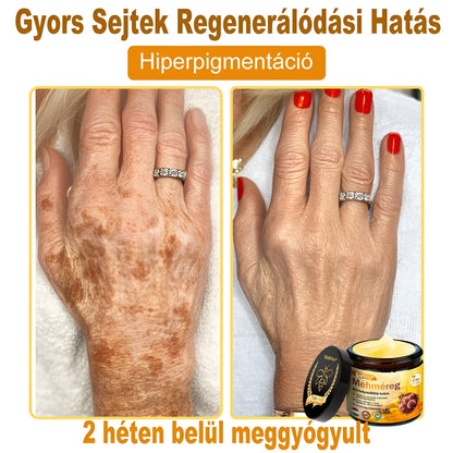 ⭐⭐ ZödVita® Méhméreg Bőr Helyreállító Krém (👨‍⚕‍CE jóváhagyott)👍✅