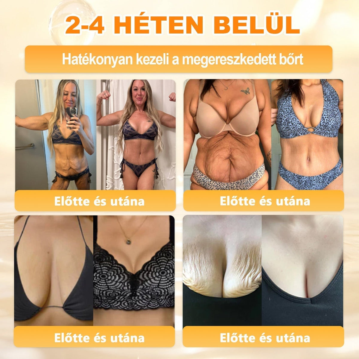 🔥🔥🔥 PuraCure® Méhméreg Bőr Helyreállító Krém (👨‍⚕‍CE Tanúsítvány)👍✅