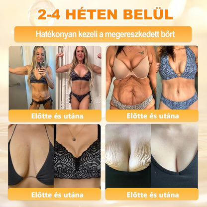 🔥🔥🔥 PuraCure® Méhméreg Bőr Helyreállító Krém (👨‍⚕‍CE Tanúsítvány)👍✅