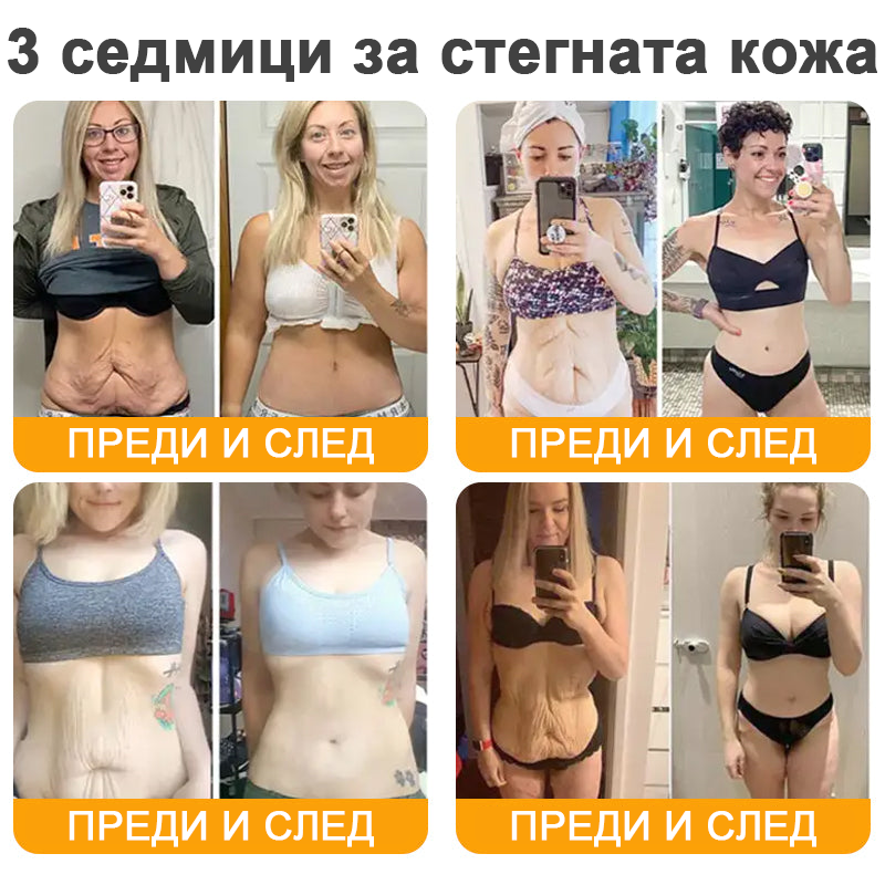 REHELY® Крем с пчелна отрова за регенерация на кожата – Подходящ за всички възрасти и типове кожа)