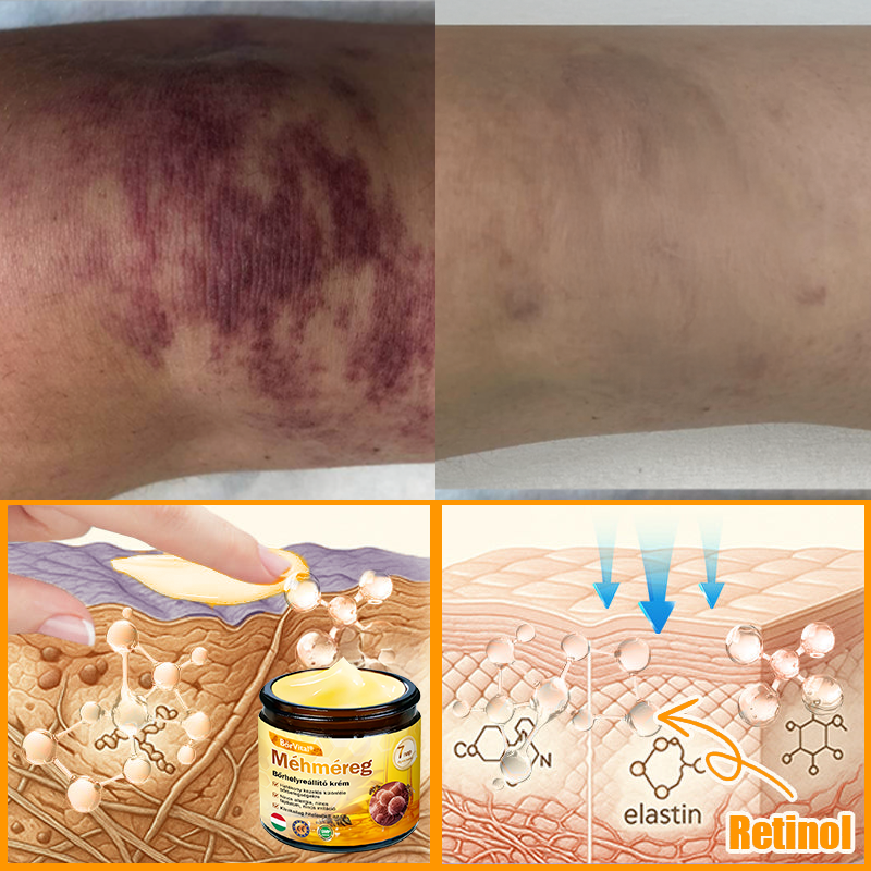 ⭐⭐ ZödVita® Méhméreg Bőr Helyreállító Krém (👨‍⚕‍CE jóváhagyott)👍✅